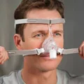 philips-pico-nasal-mask-l-wearing-front