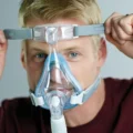 philips-respironics-amara-full-face-mask-fitting-medidevice-delhi